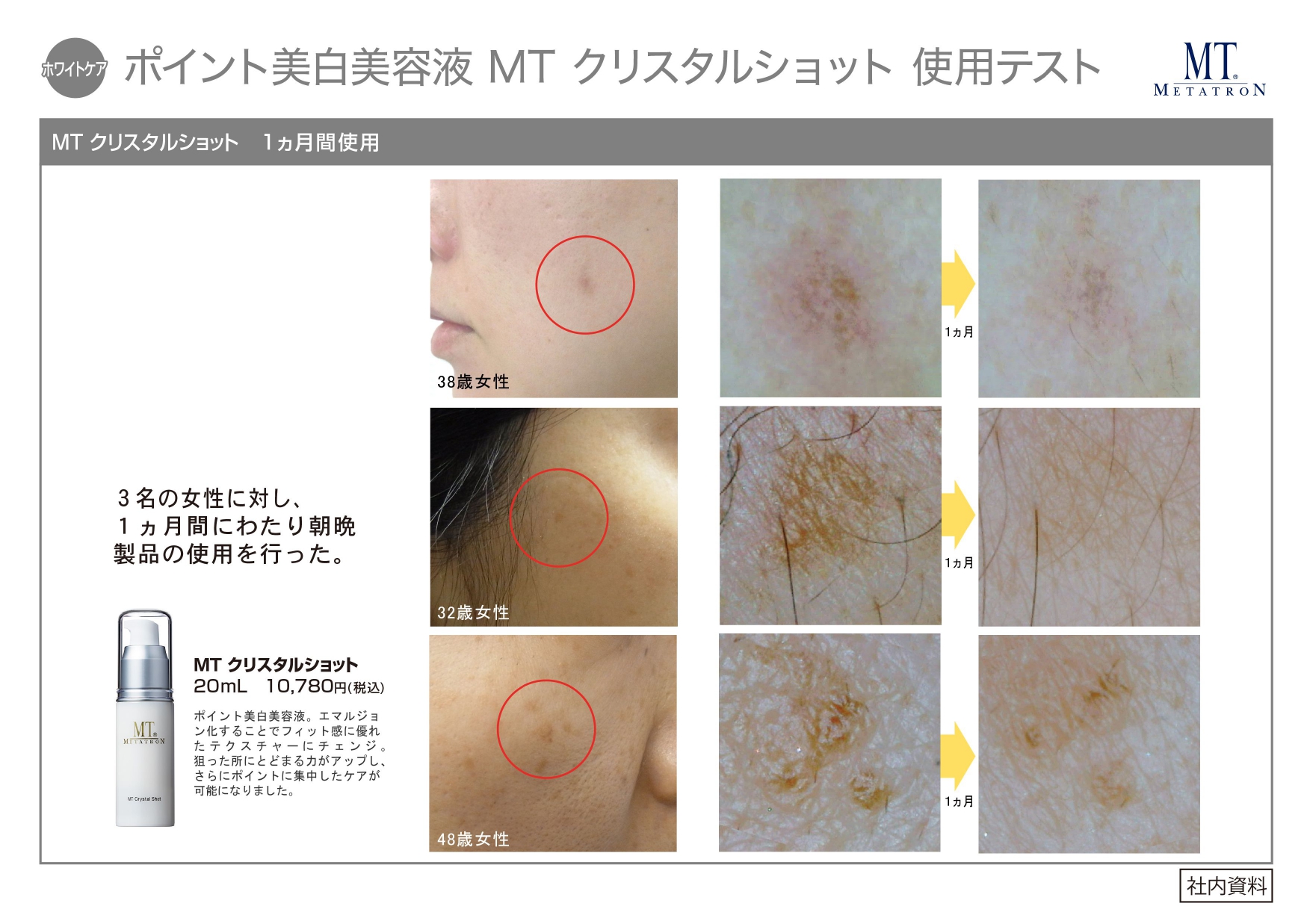 MT クリスタルショット 1ヵ月使用テスト